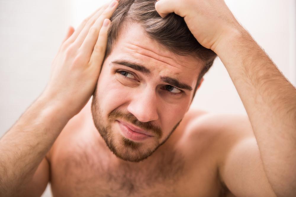 Some strategies to know to prevent balding in men