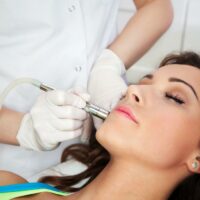 The procedure of laser skin resurfacing